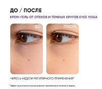 ICON SKIN Крем-гель от отеков Йога для глаз / Smart Eyes Yoga Anti Puff Cream Gel 15 мл, фото 8
